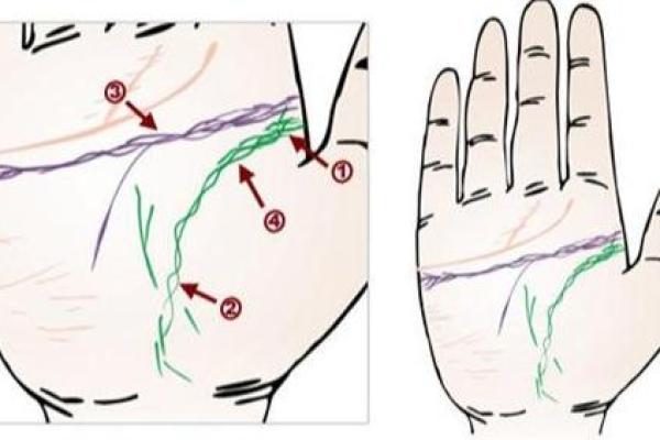 手相锁链纹路背后隐藏的命运启示