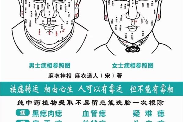 男士去痣的必要性与方法解析