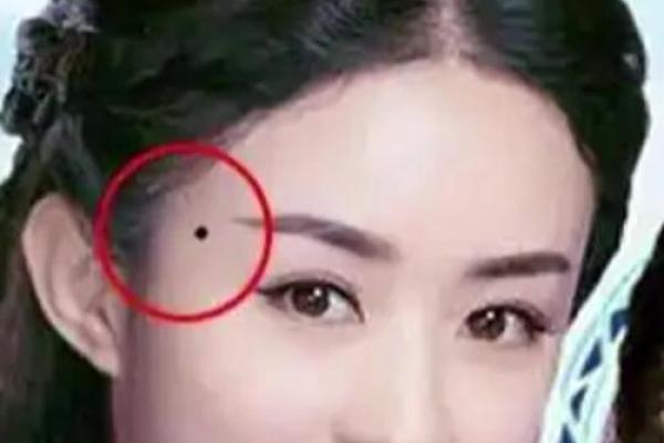 识别命运之痣，相征老易痣揭秘