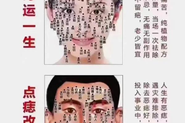 眼中有痣，命运不凡