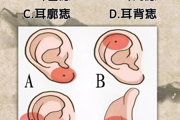 耳朵上的秘密，这颗痣到底藏着什么？