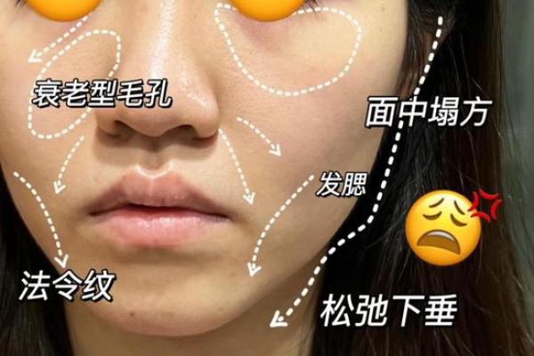 八字纹在女人脸上究竟代表什么？专家给出答案