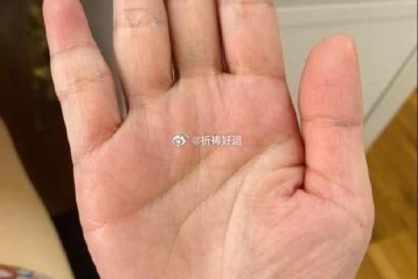 手相揭秘：无名指凹陷暗示哪些运势，错过你就亏大了
