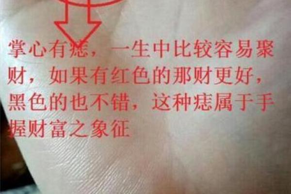 巨富的标志？这颗痣竟预示着男人大富大贵，快来一探究竟