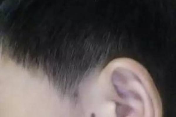 左耳痣的神奇魔力，让她一夜成名