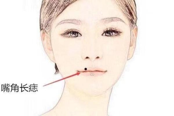 女人痣相揭秘：嘴上痣，福运连连？