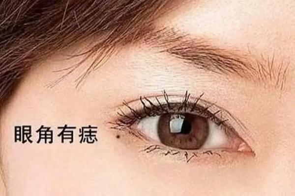眼皮上的痣，预示着什么？痣相大全为你揭晓