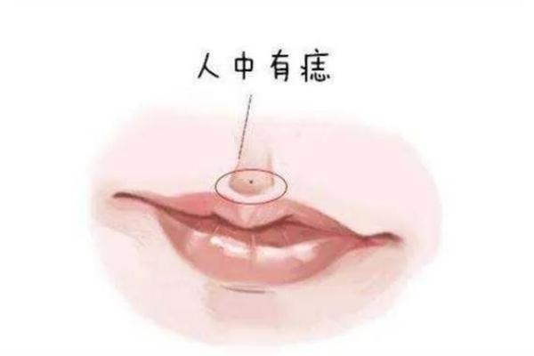 嘴唇痣的神秘力量，让你成为焦点人物