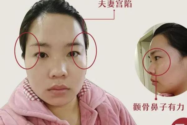 走路外八字脚会带来不好的婚姻运势吗？